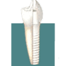 IMPLANTOLOGIA CERAMICA