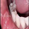 Diamond Smile Center - Praktek Dokter Gigi drg. M. Ari Zakaria dan drg. Novita Andriani