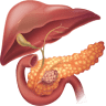 Dr. Sunil D Shenvi - Liver and Multi-Organ Transplant Surgeon