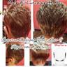 Inspired Designs Hair Loss & Hair Replacement Svcs