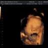 S.K.CLINIC, DR S. KRISHNAN, SRINIVAS ULTRASOUND SCAN CENTRE