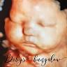 Baby's Bungalow 3D & 4D Ultrasound Buffalo NY