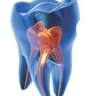 Canberra City Endodontics