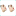 Doç.Dr. Murat Enöz, ENT Doctor, Burun Estetiği, Tip Plasty, Rhinoplasty, Nose Job Surgery, Istanbul