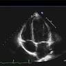 Fairbanks Cardiology