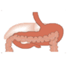 Gastrocer Genel Cerrahi Merkez