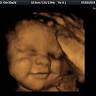 Hello Little One 4d Ultrasound Studio
