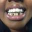 Khaotic Grillz & Tooth Gems