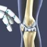 Medi-Square Hospital & Best Joint Replacement Hospital in Indore | Robotic Knee Replacement /Sports Injury/Orthopedic