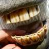 Veterinarian / equine dentist Mette Aarup