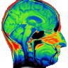 Überörtliche Radiologische Gemeinschaftspraxis Dr. Wihsgott, Dr.Aikele, Dr.Haupt