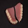 MS Dental Laboratory (Emergency Denture Repairs)