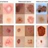 Northmead Medical Centre & Northmead Skin Cancer Clinic