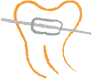 SecretSmile fogszabályozás és dentálhigiénia