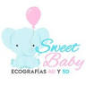 Sweet Baby Toledo - Ecografias 5D HD