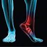 Canberra Heel Pain Institute