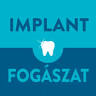 Implant Fogászat
