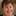 Dr Gillian Dunlop - Rhinoplasty Specialist Surgeon