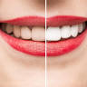 Johnson's Dental Extacy