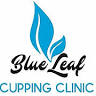Cupping Clinic E7 - Hijama in London