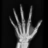 RTI Medical Systems Inc